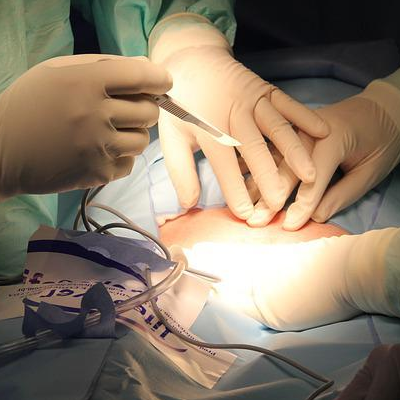 Dr. Eduardo Villanueva Manzo Artroscopía de hombro