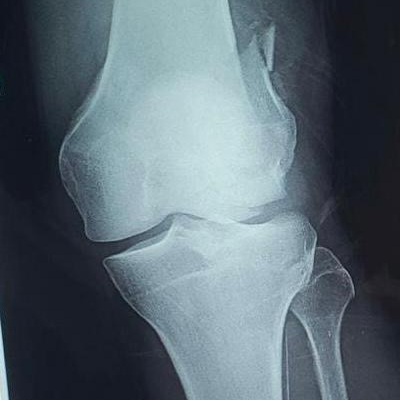 Dr. Eduardo Villanueva Manzo Traumatología