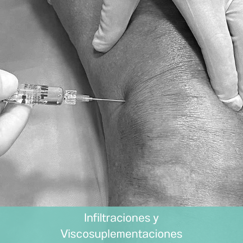 Dr. Eduardo Villanueva Manzo Infiltraciones y Viscosuplementaciones